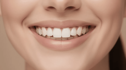 Veneers in Carmel, IN by Smiles In The Village Dentistry