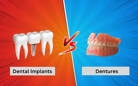 Dental Implants vs. Dentures: Which Is Best for You?