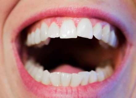 Why Preventive Dentistry in Early Spring Can Save You Time and Money