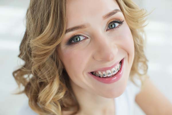 Teeth Whitening and Dental Braces - Smiles in the Village Dentistry Carmel  Indiana